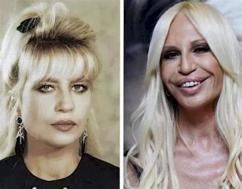 doccia donatella versace|donatella versace face what happened.